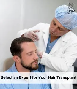 Select an Expert for Your Hair Transplant