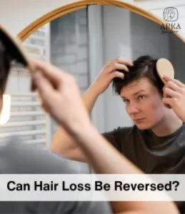 Can Hair Loss Be Reversed?