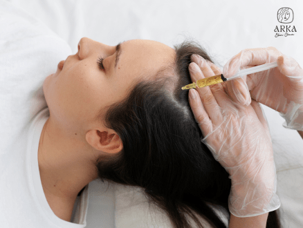 PRP therapy