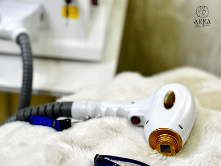 Laser Hair Removal Pre-Treatment Guidelines for Best Results