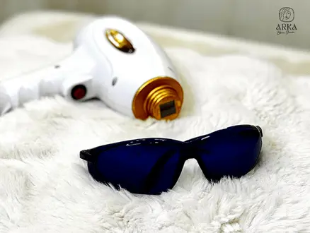 Advanced laser hair removal in Gurugram at Arka Skin Clinic