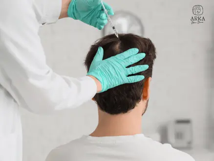 Hair transplant during winter for better healing and recovery