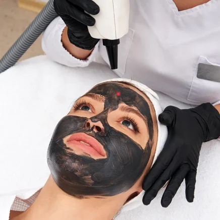 Carbon Facial & Hollywood Facial
