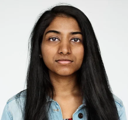 Melasma & Pigmentation Treatment