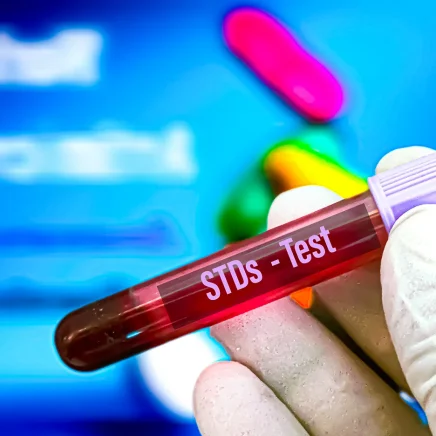 Sexually Transmitted Diseases (STDs) Treatment